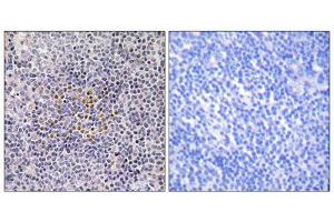 Immunohistochemistry analysis of paraffin-embedded human tonsil tissue using XRCC3 antibody. (XRCC3 Antikörper  (Internal Region))