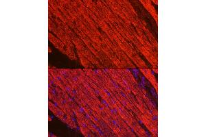 Immunofluorescence analysis of mouse heart using MYH1 Rabbit pAb (ABIN6130946, ABIN6144230, ABIN6144231 and ABIN6222678) at dilution of 1:100 (40x lens). (MYH1 Antikörper  (AA 1-100))
