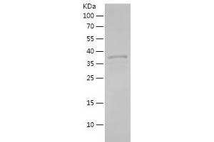 Western Blotting (WB) image for Myocyte Enhancer Factor 2C (MEF2C) (AA 350-473) protein (His-IF2DI Tag) (ABIN7124046)