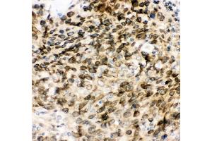 IHC analysis of MAD1 using anti-MAD1 antibody (ABIN3043387).
