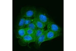 IF analysis of ENAH/MENA using anti-ENAH/MENA antibody (ABIN7601316).
