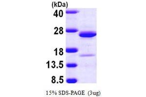 SDS-PAGE (SDS) image for Neurocalcin delta (NCALD) (AA 1-193) protein (His tag) (ABIN666638)