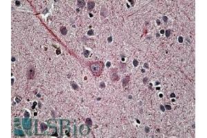 ABIN335168 (3. (SYT1 Antikörper  (Internal Region))
