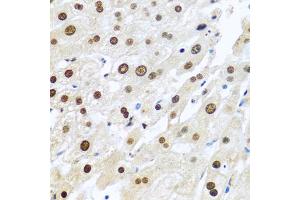 Immunohistochemistry of paraffin-embedded human liver using METTL3 antibody (ABIN5974672) at dilution of 1/100 (40x lens). (METTL3 Antikörper)