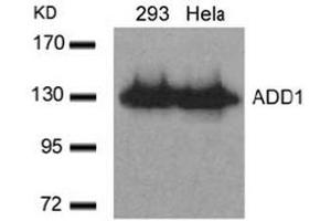 Image no. 3 for anti-Adducin 1 (Alpha) (ADD1) (Ser726) antibody (ABIN197406) (alpha Adducin Antikörper  (Ser726))