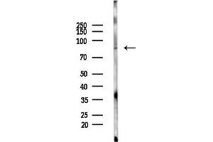 Western blot analysis of lysates from Rat brain, using PHEX Antibody at 1/1000 dilution.