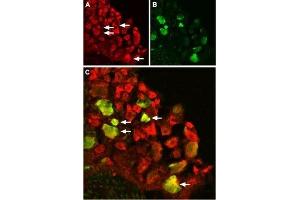 Expression of TRPV1 in rat DRG - Immunohistochemical staining of rat dorsal root ganglion (DRG) using Anti-TRPV1 (VR1) Antibody (ABIN7043841, ABIN7043988 and ABIN7043989). (TRPV1 Antikörper  (C-Term, Intracellular))