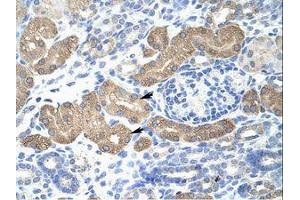 Image no. 1 for anti-Lethal(3) Malignant Brain Tumor-Like Protein 2 (L3MBTL2) (AA 576-625) antibody (ABIN202876) (L3MBTL2 Antikörper  (AA 576-625))