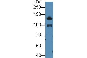 Western Blotting (WB) image for anti-Cadherin 1, Type 1, E-Cadherin (Epithelial) (CDH1) (AA 751-884) antibody (ABIN7437818)