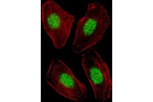 Fluorescent image of  cell stained with NR1H3 Antibody (Center) (ABIN653910 and ABIN2843147). (NR1H3 Antikörper  (AA 226-253))