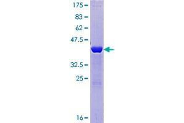 BLOC1S2 Protein (AA 1-142) (GST tag)