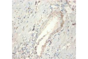 Immunohistochemistry of paraffin-embedded human prostate tissue using ABIN7152807 at dilution of 1:100 (FGF21 Antikörper  (AA 29-209))