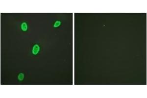 Immunofluorescence analysis of HeLa cells, using Histone H4 (Acetyl-Lys12) Antibody.