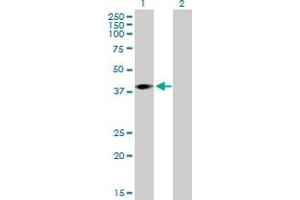 Western Blot analysis of ARPM1 expression in transfected 293T cell line by ARPM1 MaxPab polyclonal antibody. (ARPM1 Antikörper  (AA 1-372))
