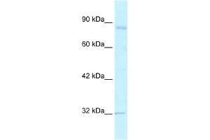 WB Suggested Anti-BRD2 Antibody Titration:  2. (BRD2 Antikörper  (C-Term))