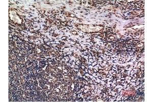 Immunohistochemical analysis of paraffin-embedded Human Tonsil Tissue using Cyclin B1 Mouse mAb diluted at 1:200. (Cyclin B1 Antikörper)