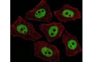 Immunofluorescent analysis of A549 cells using XRCC1 antibody at 1:25. (XRCC1 Antikörper  (AA 407-435))
