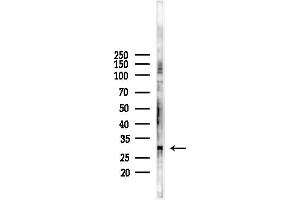 Western blot analysis of lysates from LoVo cells(heat-shock,45 min treatment), using KCNM Antibody at 1/1000 dilution.