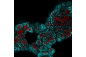 Confocal immunofluorescence image of MCF-7 cells using Cytokeratin 15 Mouse Monoclonal Antibody (KRT15/2959) followed by Goat anti-Mouse CF488 (Cyan) and Reddot is used to label the nuclei Red. (KRT15 Antikörper)