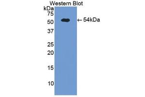 Detection of Recombinant SELE, Porcine using Polyclonal Antibody to E-selectin (Selectin E/CD62e Antikörper  (AA 260-420))