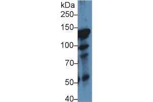 Western Blot; Sample: Rat Lung lysate; Primary Ab: 1µg/ml Rabbit Anti-Rat ITIH4 Antibody Second Ab: 0. (ITIH4 Antikörper  (AA 478-722))