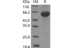 Western Blotting (WB) image for Lipoprotein-Associated phospholipase A2 (Lp-PLA2) protein (His tag) (ABIN7319997)
