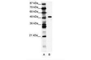 Image no. 1 for anti-Zinc Finger Protein 541 (ZNF541) (AA 783-832) antibody (ABIN203199) (ZNF541 Antikörper  (AA 783-832))