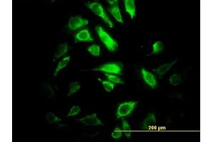 Immunofluorescence of monoclonal antibody to PSMB10 on HeLa cell. (PSMB10 Antikörper  (AA 1-273))