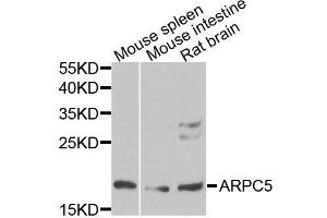 Western blot analysis of extracts of various cell lines, using ARPC5 antibody (ABIN5996446) at 1/1000 dilution. (ARPC5 Antikörper)