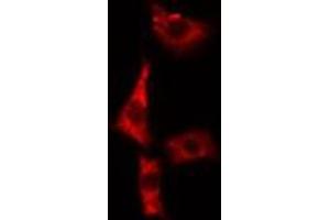 ABIN6279421 staining A549 cells by IF/ICC. (EIF3S1 Antikörper  (Internal Region))