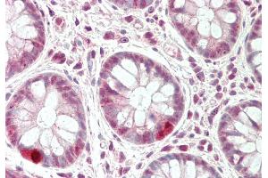 Rabbit Anti-CXXC1 antibody  Formalin Fixed Paraffin Embedded Tissue: Human Colon Primary antibody Concentration: 1:100 Secondary Antibody: Donkey anti-Rabbit-Cy3 Secondary Antibody Concentration: 1:200 Magnification: 20x Exposure Time: 0. (CXXC1 Antikörper  (Middle Region))