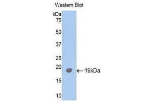 Western Blotting (WB) image for anti-Activin Receptor Type I (ACRV1) (AA 208-340) antibody (ABIN1174014) (ACVR1 Antikörper  (AA 208-340))