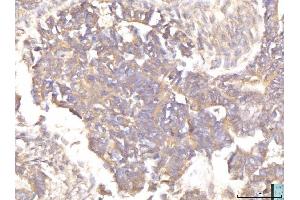 IHC analysis of EIF4B using anti-EIF4B antibody (ABIN7599496). (EIF4B Antikörper  (AA 1-611))