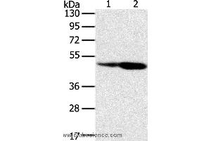 Western blot analysis of Hepg2 and hela cell, using SNX8 Polyclonal Antibody at dilution of 1:400 (SNX8 Antikörper)