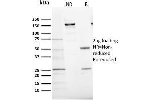 SDS-PAGE Analysis Purified Ki67 Mouse Monoclonal Antibody (MKI67/2466). (Ki-67 Antikörper  (AA 2293-2478))