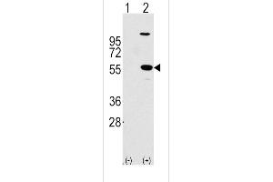 Western blot analysis of ALDH1A1 using rabbit polyclonal ALDH1A1 Antibody using 293 cell lysates (2 ug/lane) either nontransfected (Lane 1) or transiently transfected with the ALDH1A1 gene (Lane 2). (ALDH1A1 Antikörper  (AA 302-331))