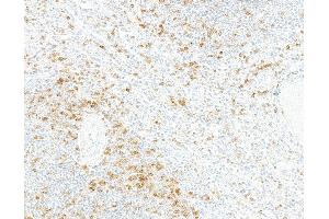 Immunohistochemistry (IHC) image for anti-CD5 (CD5) (AA 25-371) antibody (ABIN7449418)