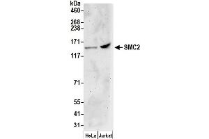 Western Blotting (WB) image for anti-Structural Maintenance of Chromosomes 2 (SMC2) (AA 950-1000) antibody (ABIN7449170)