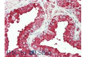IHC-P analysis of Human Prostate Gland Tissue, with HE staining. (CPT1A Antikörper  (AA 191-353))