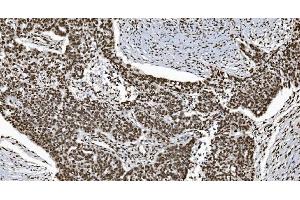 IHC analysis of Ku70 using anti-Ku70 antibody (ABIN7602791).