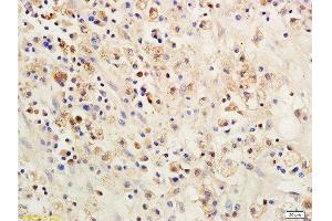 Formalin-fixed and paraffin embedded: rat brain tissue labeled with Anti-SOCS 1 Polyclonal Antibody , Unconjugated 1:200 followed by conjugation to the secondary antibody and DAB staining (SOCS1 Antikörper  (AA 121-211))