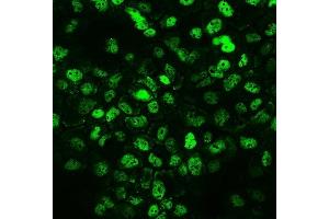 IF analysis of CCT3 using anti-CCT3 antibody (ABIN4886513).
