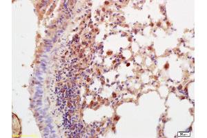 Formalin-fixed and paraffin embedded mouse lung labeled with Anti-Prostaglandin E Receptor EP2 Polyclonal Antibody, Unconjugated (ABIN755248) at 1:200 followed by conjugation to the secondary antibody and DAB staining. (PTGER2 Antikörper  (AA 271-358))