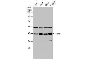 WB Image Various whole cell extracts (30 μg) were separated by 10% SDS-PAGE, and the membrane was blotted with RAP antibody [N1C3] , diluted at 1:1000. (LRPAP1 Antikörper  (Center))