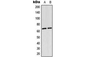 Western blot analysis of NF-kappaB p65 (AcK310) expression in HeLa (A), mouse lung (B) whole cell lysates. (NF-kB p65 Antikörper  (acLys310))