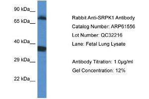Western Blotting (WB) image for anti-SRSF Protein Kinase 1 (SRPK1) (C-Term) antibody (ABIN2788838) (SRPK1 Antikörper  (C-Term))