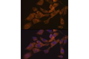 Immunofluorescence analysis of NIH-3T3 cells using KIF3A Rabbit mAb (ABIN7268132) at dilution of 1:100 (40x lens). (KIF3A Antikörper)