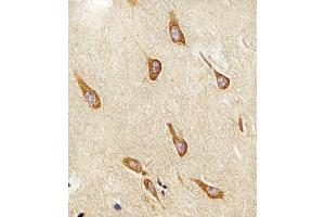 Immunohistochemical analysis of raffin-embedded H. (PAFAH1B1 Antikörper  (N-Term))