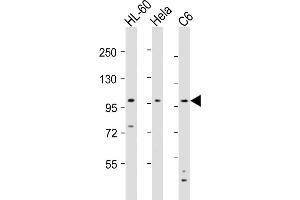 All lanes : Anti-NCSTN Antibody (N-Term) at 1:8000 dilution Lane 1: HL-60 whole cell lysates Lane 2: Hela whole cell lysates Lane 3: C6 whole cell lysates Lysates/proteins at 20 μg per lane. (Nicastrin Antikörper  (AA 99-133))
