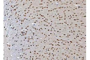 IHC analysis of THAP11 using anti-THAP11 antibody (ABIN7599230). (THAP11 Antikörper  (AA 1-294))